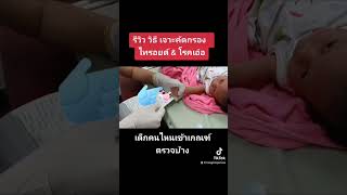 เจาะคัดกรองโรคเอ๋อ และไทรอยด์ พ่อแม่มือใหม่ต้องดู