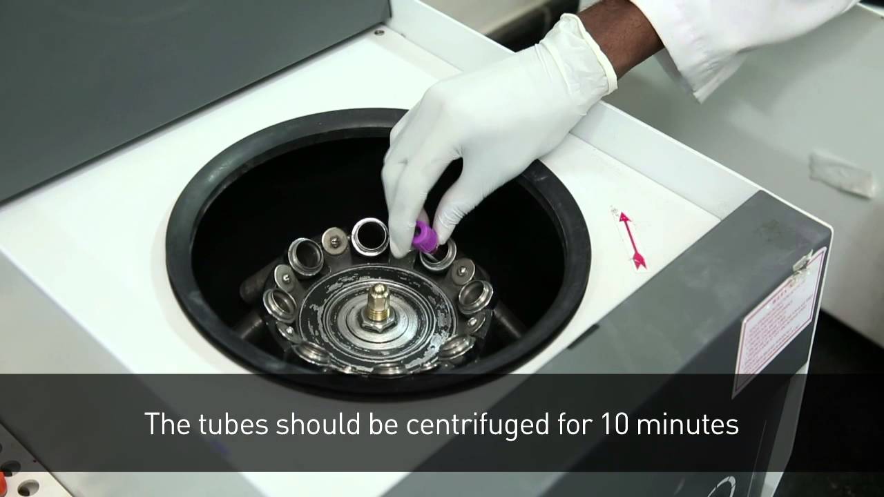 Healthcare Blood Plasma Processing Method YouTube