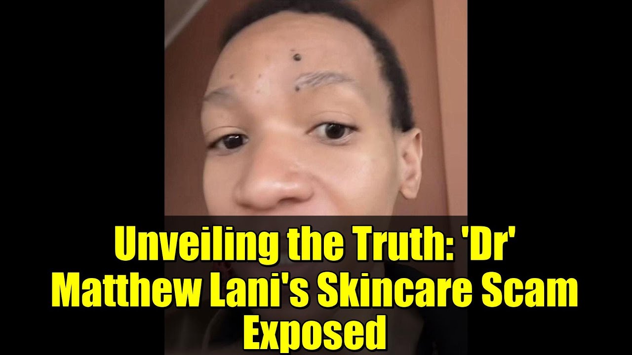 Unveiling the Truth: 'Dr' Matthew Lani's Skincare Scam Exposed