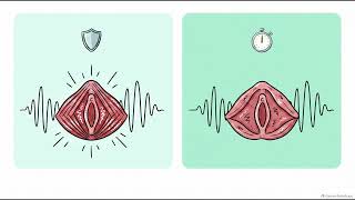 How might HIFEM affect leakage during coughing or exercise? | WHC Clinical FAQ