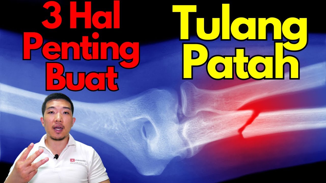 3 hal penting buat TULANG 🦴 yang PATAH !