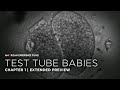 IVF and the History of Test Tube Babies