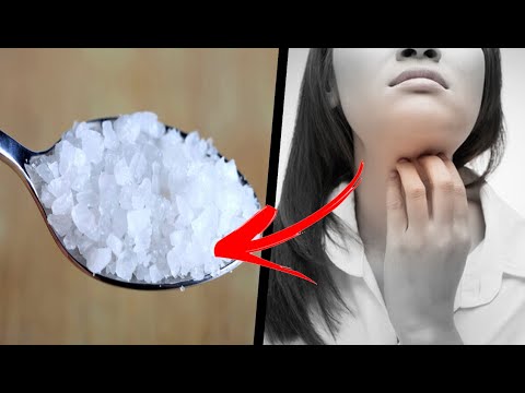 Vídeo: Remedio Para La Picazón En La Garganta: Causas Y Remedios Caseros Naturales