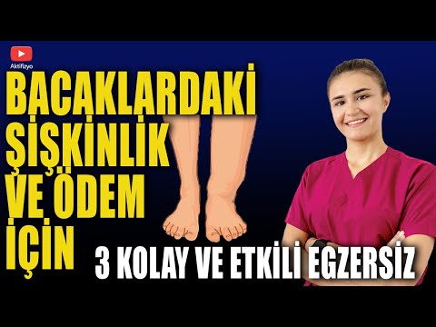 Video: Bacak Ülserlerini Doğal Olarak İyileştirmenin 3 Kolay Yolu