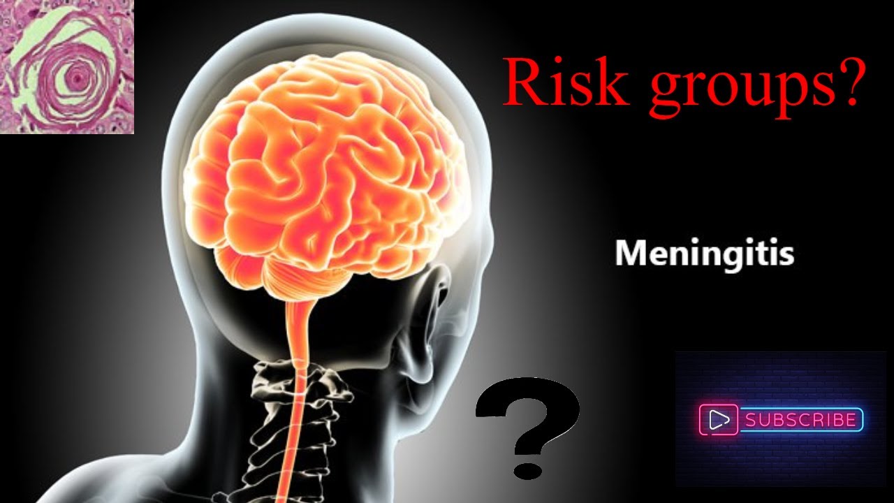 What Is Meningitis Causes Symptoms Risk Groups How To Approach It