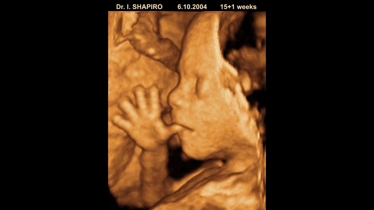 3d Fetal Ultrasound Amazing Things Fetuses Do In The Womb Dr I Shapiro Youtube