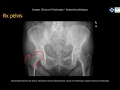 Anatomía Rx Pelvis