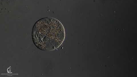 Ciliated protozoa, 200-400x Differential interference contrast