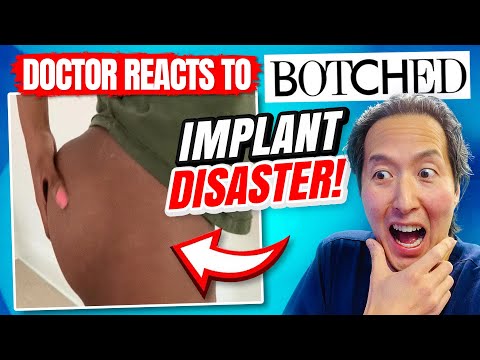 Plastic Surgeon Reacts to BOTCHED - What Happened to This BUTT IMPLANT?