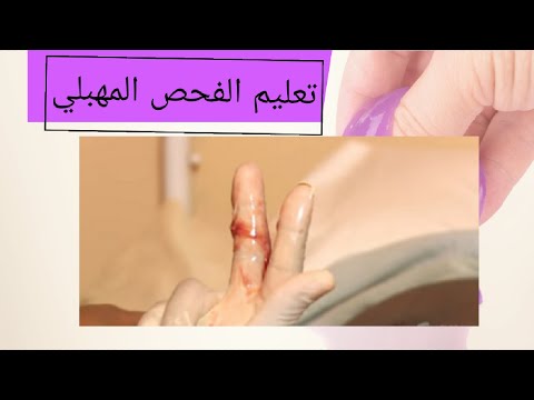 فيديو: كيفية وضع ضمادة قبل الولادة