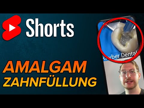 Video: Seit wann gibt es Amalgamfüllungen?