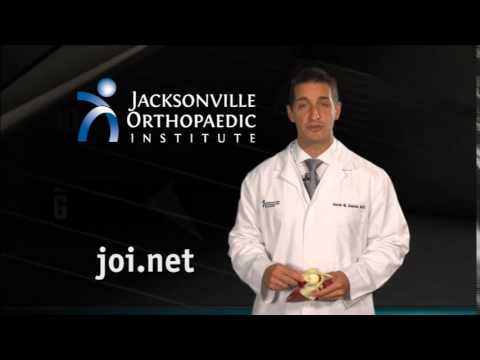 Kevin M. Kaplan, MD - Shoulder Dislocation