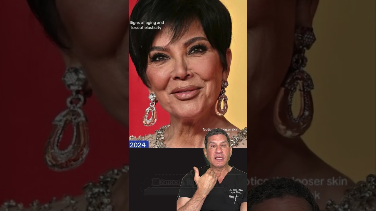 Kris Jenner Got A Facelift?! Let's break it down!