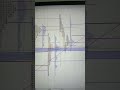 Live trading Nifty banknifty option trading analysis Market profile orderflow