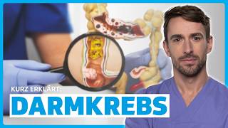 Darmkrebs verstehen: Ursachen, Symptome, Diagnose & Therapie | DocTommy