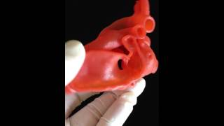 IMIB-CHD|CASE8B|DORV with a non-committed VSD