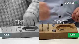 Before/After recoveriX - stroke - 9HPT - ST8