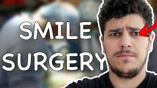 I had a smile surgery. Here's what happened...