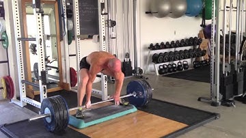 Celebrating My New 5 Fingers with Deadlifts