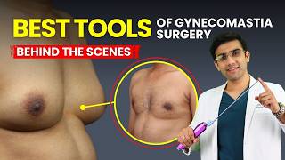 Complete Guide to Gynecomastia Surgery Instruments | Step-by-Step Procedure with Dr. Dhruv Chavan