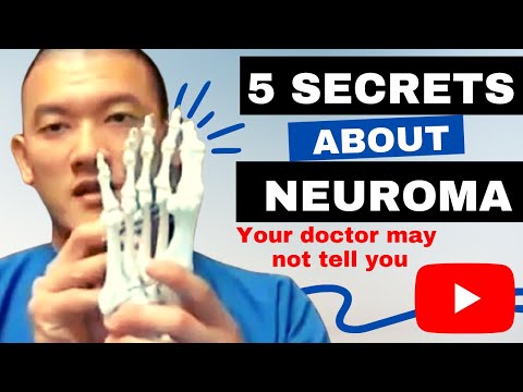 5 Secrets about Neuromas your doctor may not tell you