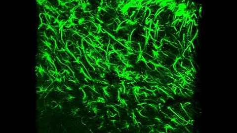 GFAP staining astrocytes near ventricle