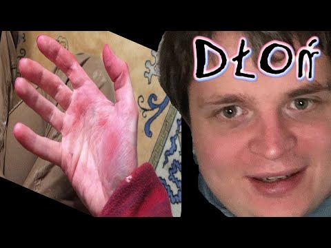 Moja dłoń jest Czerwona 🔴