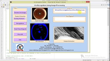 Iris Recognition Using Image Processing Full Matlab Project with Source Code