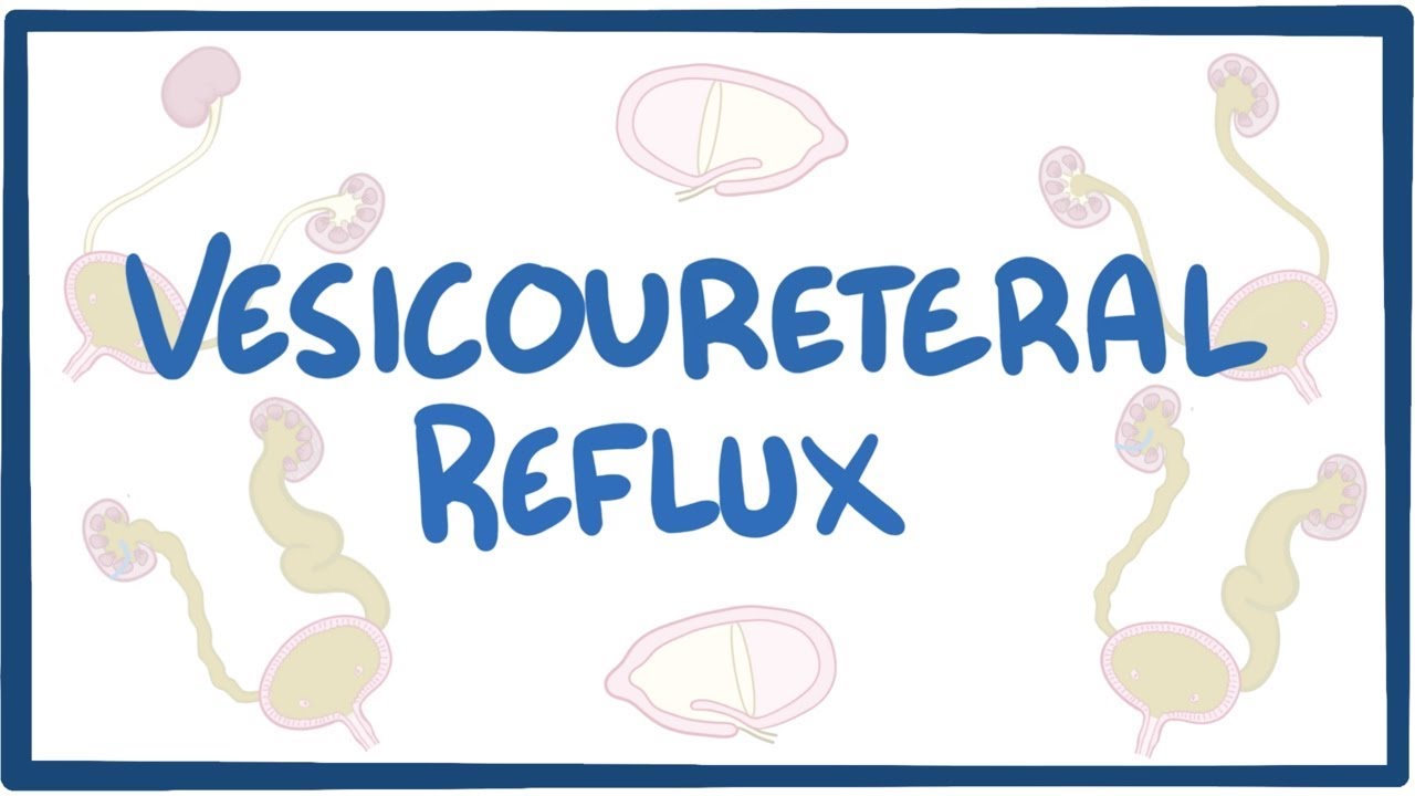 Vesicoureteral Reflux Causes Symptoms Diagnosis Treatment Vesicoureteral Reflux Causes Symptoms Diagnosis Treatment