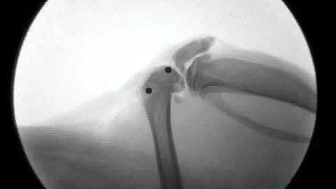 Orthopedic procedure on rat leg