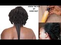 OVERNIGHT EXTREME HAIR GROWTH TREATMENT (Use Twice Weekly For Faster Results