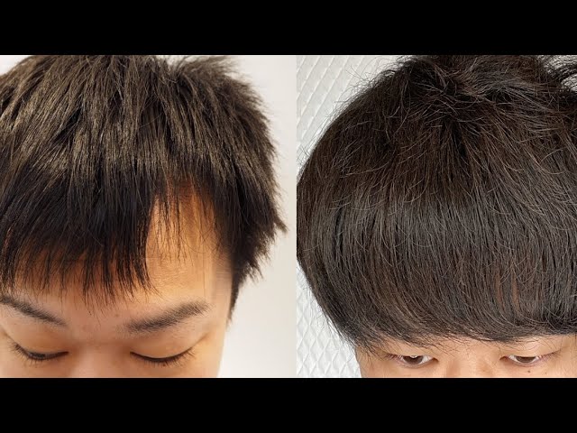 将来禿げる mqdefault.jpg