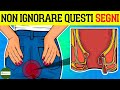 SEGNI precoci di TUMORE al COLON che NON DEVI IGNORARE