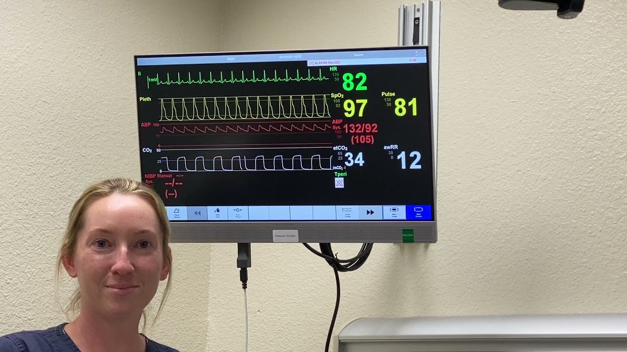 How to Read Patient Monitors - CanadiEM