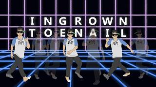 "Ingrown Toenail"