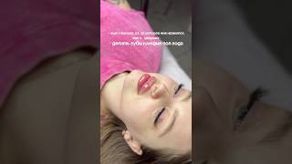 Увеличение губ Краснодар #губыкраснодар #косметология #увеличениегуб #увеличениегубкраснодар #космет
