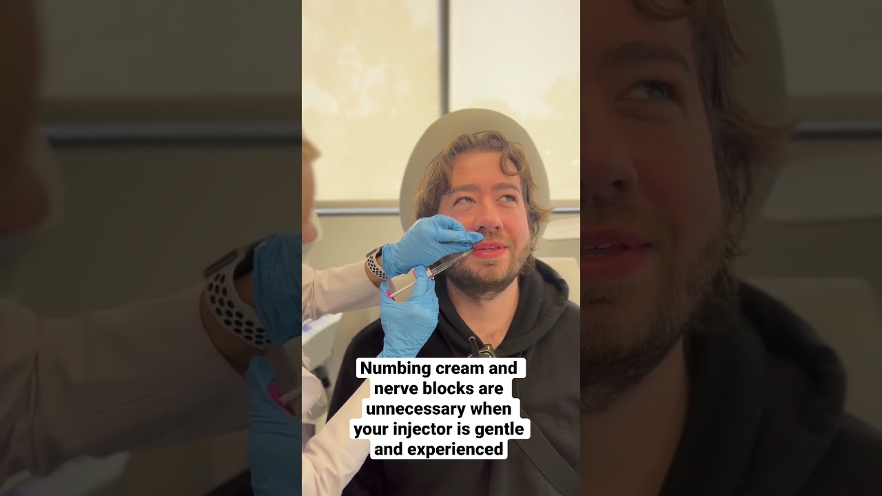 Male lip enhancement with Volbella 