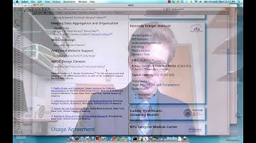 Resting State Analysis, Part VII: The End