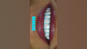 Dental Motion Graphic | Animation that Makes You Smile #dentistry #dentist #dental_motion_graphic