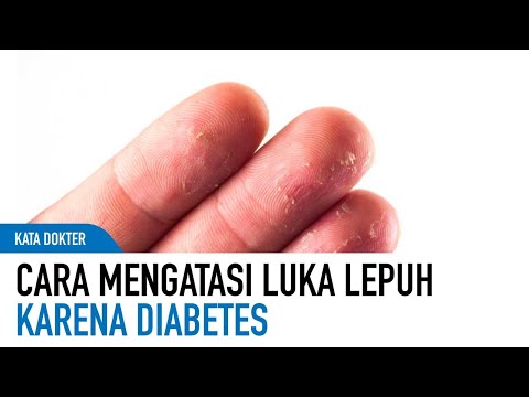 Video: Cara Menghilangkan Lepuh Darah: 11 Langkah (dengan Gambar)