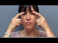 Eye Exercises during the Paresis stage of facial palsy