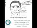 ماذا تعرف عن شلل العصب السابع ابو وجه