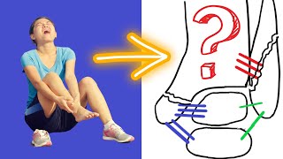 Which Bones are BROKEN in an ANKLE FRACTURE?