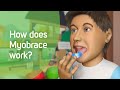 How Does Myobrace Work?