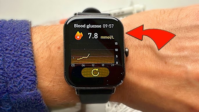CES 2021: El 'Apple Watch' para diabéticos que mide los niveles de azúcar  en sangre sin pinchazos