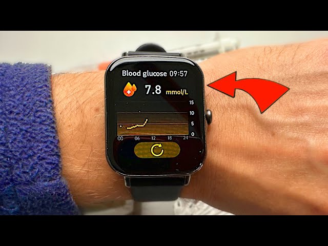 I Tried a Non-Invasive Blood Sugar Watch. Miracle or Scam? class=