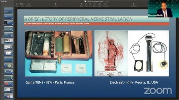 Concepts of Peripheral Nerve Stimulation