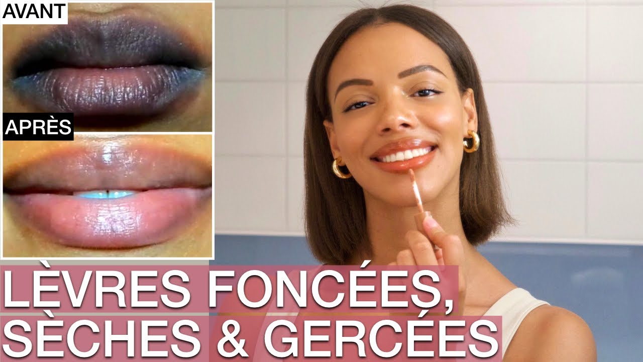 S.O.S: Lèvres Foncées, Gercées et Sèches: Comment les soigner ?