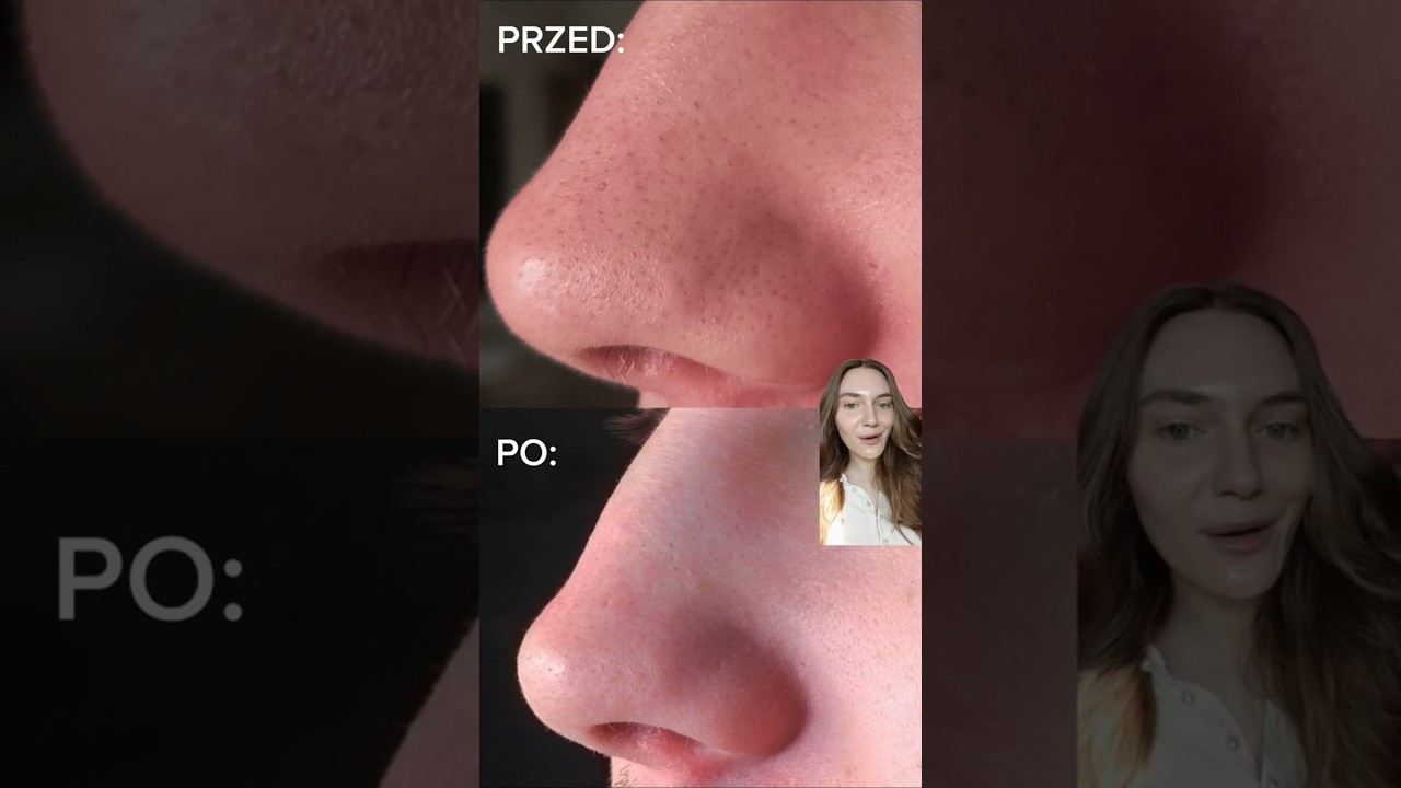 #pielegnacja #skincare [materiał powstał przy kampanii reklamowej TikTok] publikuję r&oacute;wnież tutaj!❣️
