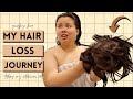 taking my hair extensions out AT HOME + my HAIR LOSS story